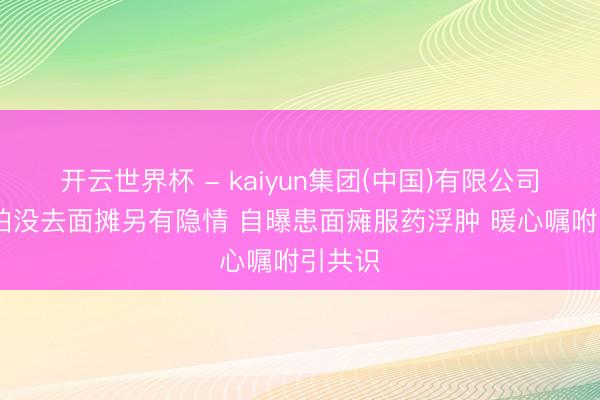 开云世界杯 - kaiyun集团(中国)有限公司 潘玮柏没去面摊另有隐情 自曝患面瘫服药浮肿 暖心嘱咐引共识